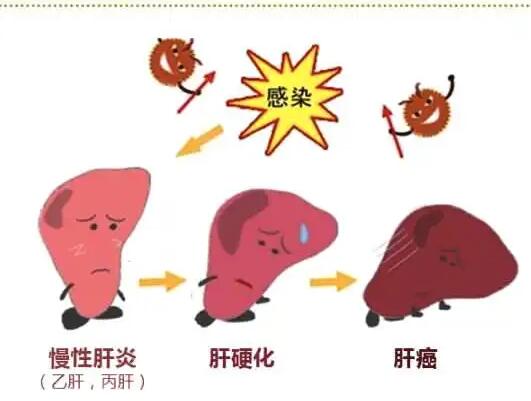 麻豆操逼网站廠家提醒肝髒疾病治不好？要了解是否含鐵食物攝入多